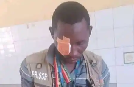 Siguiri : un journaliste de Djoma battu à sang par des policiers, ses matériels de travail endommagés (URTELGUI)