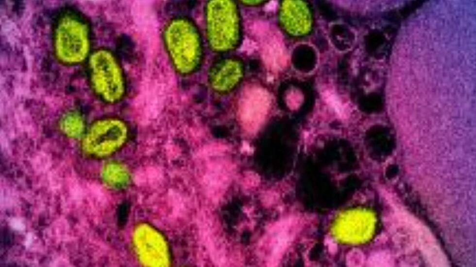 Que sait-on de la résurgence des cas de mpox en Afrique ?