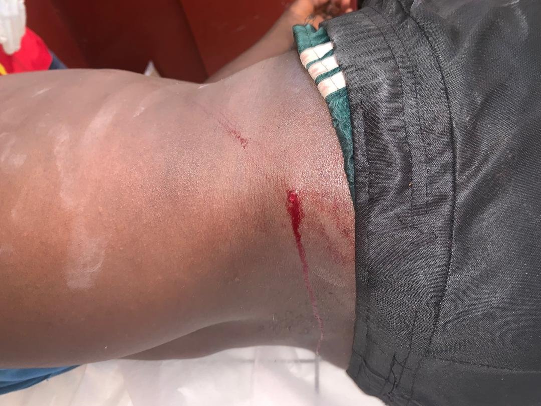 Guinée-Côte d’Ivoire : un affrontement frontalier fait plusieurs blessés